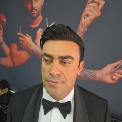 پروتزمو(کاشت مو)